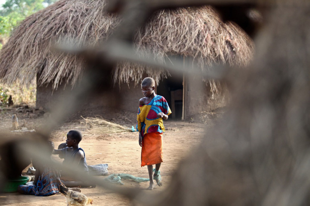 “She’s still attacked by the nodding syndrome. She does not miss a day but the impact is no longer as serious as it used to be. Today she nodes maybe twice a day, as opposed to about 10 times she used to be attacked,” Odongkara says, seated under the tree he use to tie his daughter.