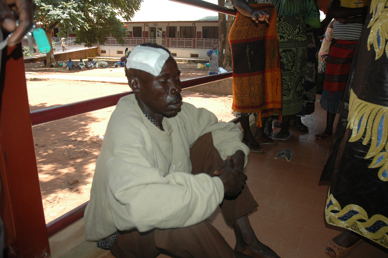 Komakech David with a bullet bruise head after an operation in sugery one in Lacor