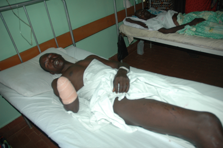 Opiyo Felix with Amputated arm in Lacor Hospital